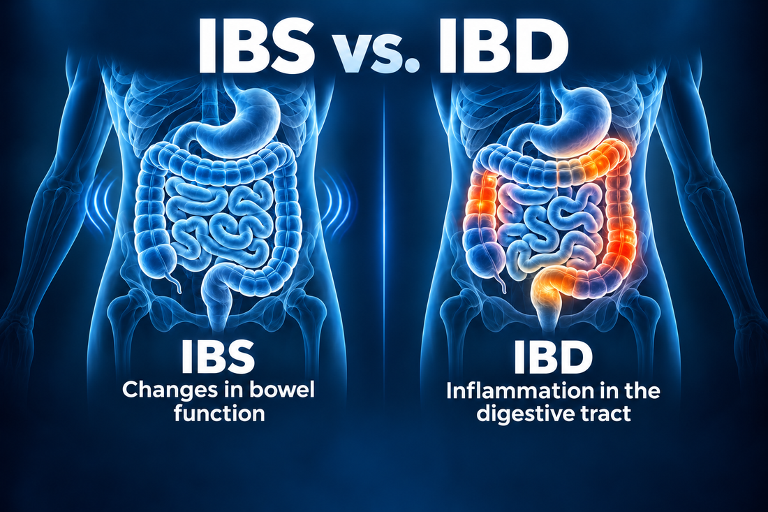Anatomical comparison of IBS-related changes in bowel function and IBD-related inflammation in the digestive tract.